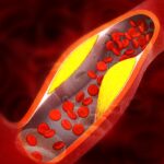 medico-vascular-aponta-6-vegetais-que-beneficiam-a-saude-das-arterias