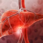 gordura-no-figado:-nutri-revela-o-que-comer-para-reverter-a-esteatose