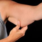 nutrologa-da-dicas-de-como-emagrecer-sem-flacidez