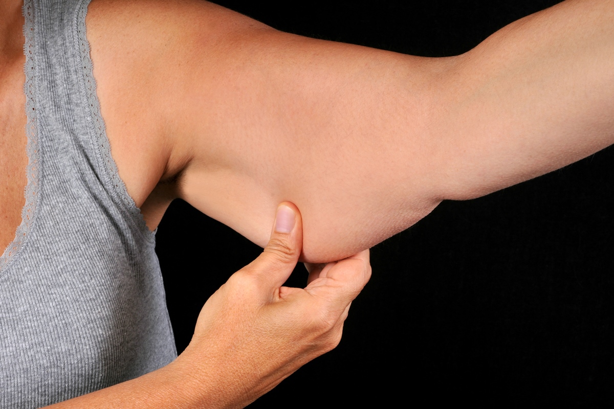 nutrologa-da-dicas-de-como-emagrecer-sem-flacidez