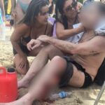 atropelado-por-lancha,-banhista-tem-perna-lacerada-no-litoral-de-sp