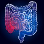tres-frutas-saborosas-que-ajudam-a-reduzir-a-inflamacao-no-intestino