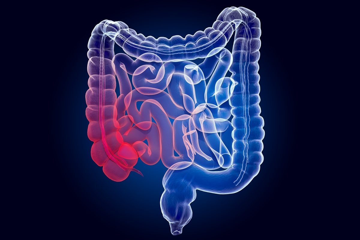 tres-frutas-saborosas-que-ajudam-a-reduzir-a-inflamacao-no-intestino