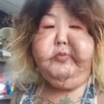 veja-o-resultado-da-cirurgia-orofacial-da-influenciadora-juju-do-pix