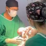 morre-mateus,-segundo-gemeo-siames,-apos-cirurgia-de-separacao