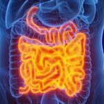 nutri-cita-alimentos-que-ajudam-a-combater-a-inflamacao-do-intestino
