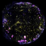 cientistas-criam-minipulmao-para-estudar-como-a-tuberculose-o-infecta