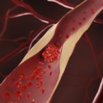 medica-vascular-cita-os-3-melhores-suplementos-beneficos-a-circulacao
