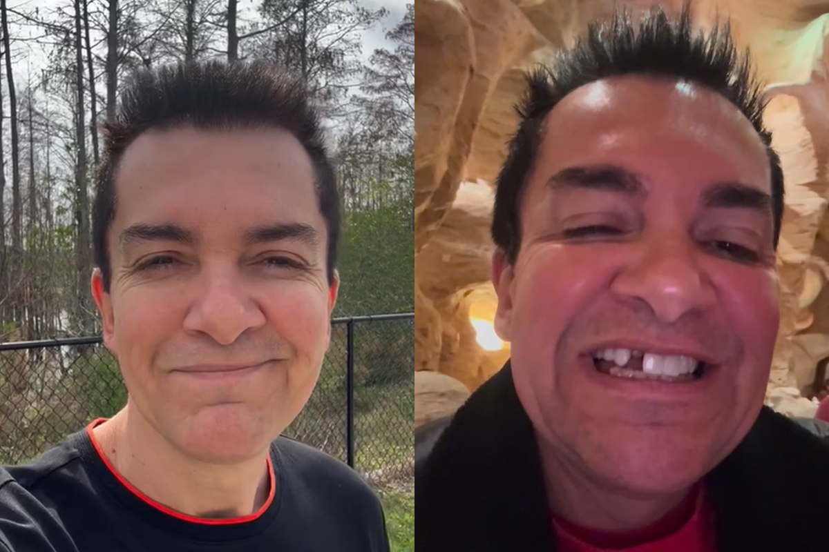 regis-danese-viraliza-apos-perder-dente-durante-viagem-aos-eua.-video