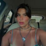 dermatilomania:-medica-revela-o-que-agrava-transtorno-de-giulia-costa