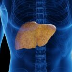 nutricionista-diz-quais-alimentos-ajudam-a-reduzir-a-gordura-no-figado