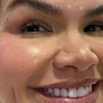 saiba-qual-procedimento-thais-carla-fez-no-rosto-apos-perder-80-kg