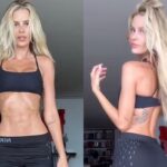 antes-e-depois-de-yasmin-brunet-apos-tratar-lipedema-e-impressionante