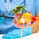nova-descoberta-da-esperanca-para-o-tratamento-de-cancer-de-pancreas