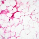 gordura-bege-pode-melhorar-funcao-vascular-e-pressao,-indica-estudo