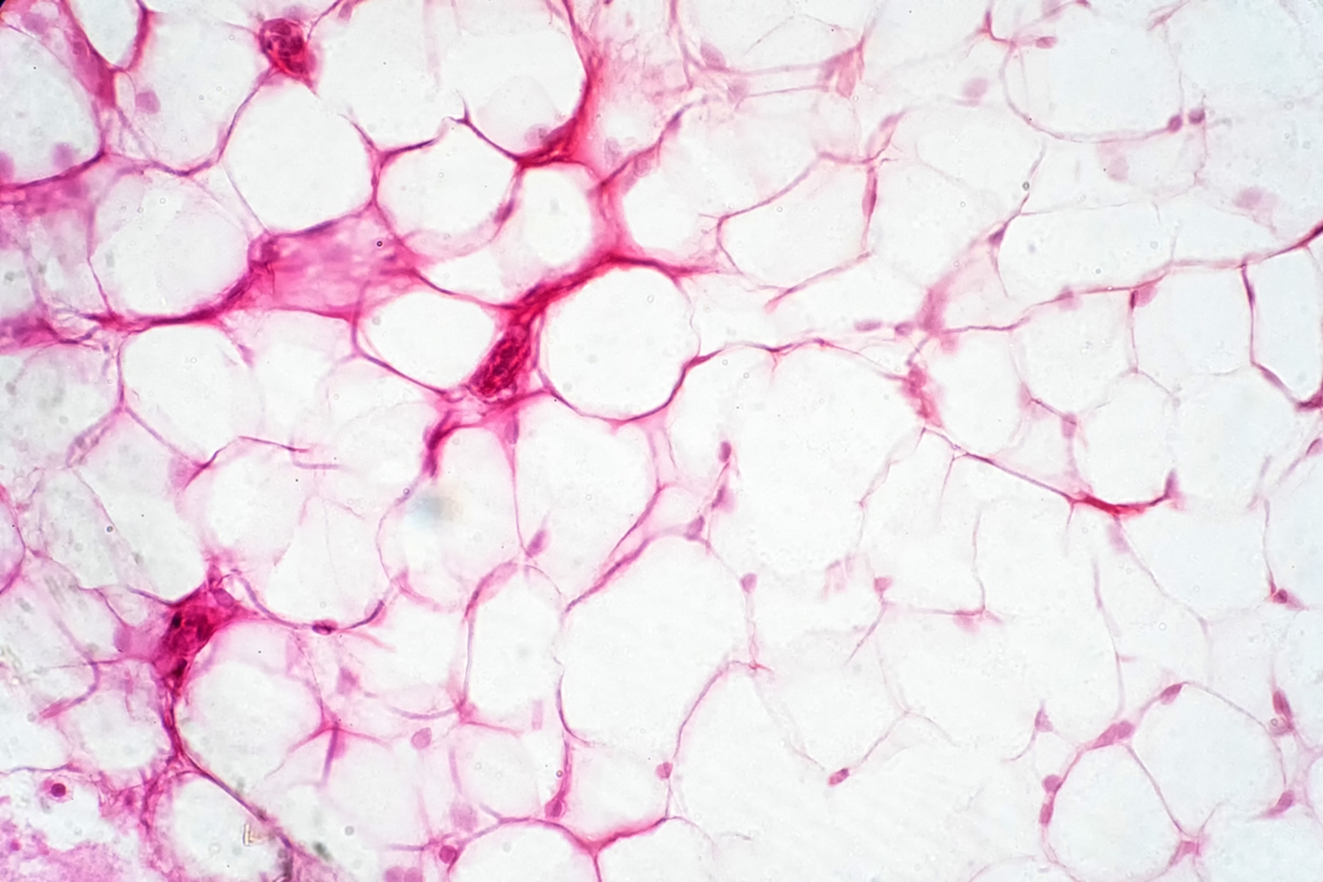 gordura-bege-pode-melhorar-funcao-vascular-e-pressao,-indica-estudo