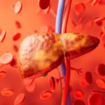 hepatologista-explica-o-que-mais-tende-a-provocar-o-colapso-do-figado